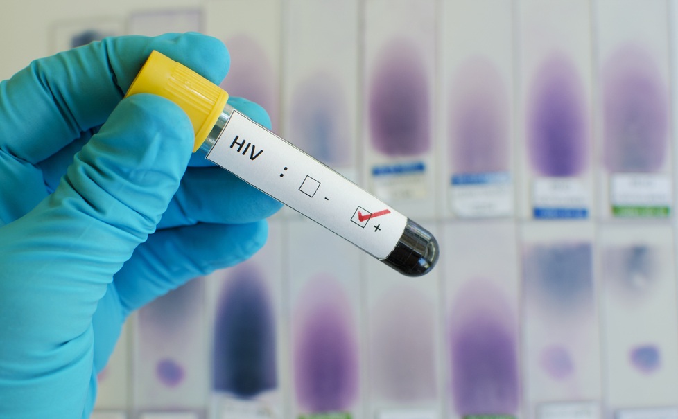 #Fallos Medicina prepaga y enfermedad preexistente: La empresa de salud deberá mantener la afiliación del actor, autorizando el cobro de un valor diferencial de cuota, debido a la preexistencia comprobada de HIV