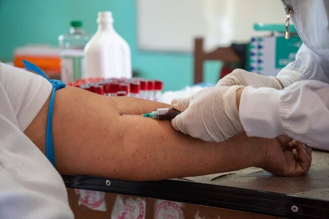 Bolivia refuerza la vigilancia para reducir la letalidad de hantavirus y la leptospirosis en zonas endémicas – OPS/OMS