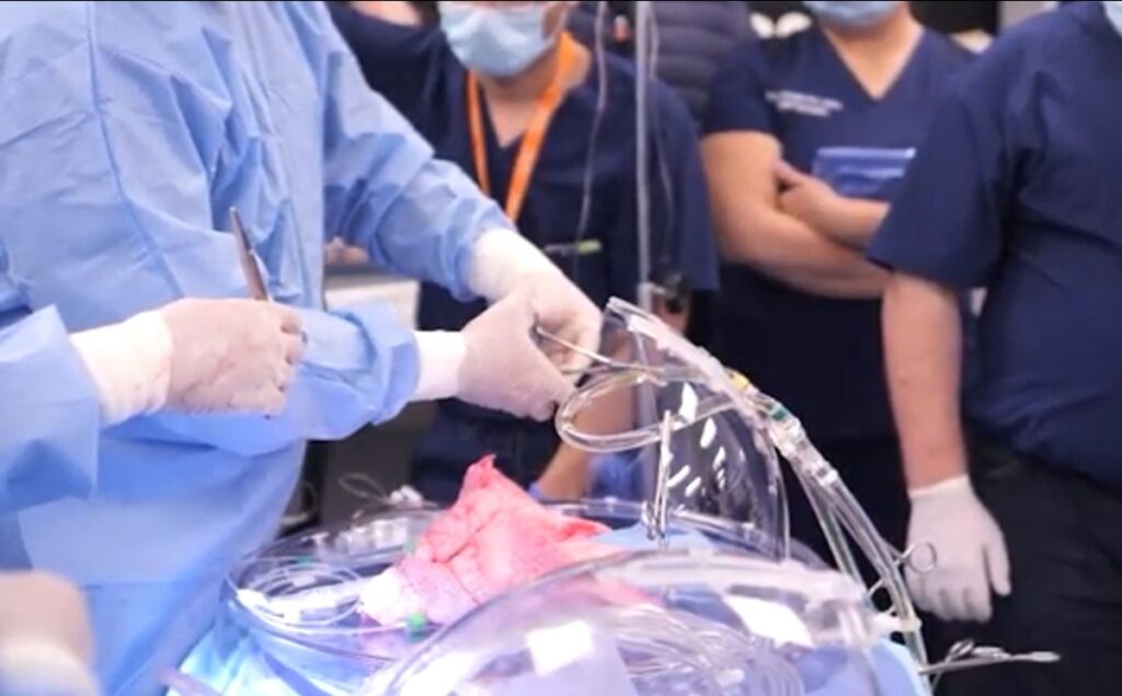 Un sistema de respiración artificial mantiene vivo a un paciente
